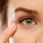 blefaroplastia